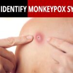 Monkeypox